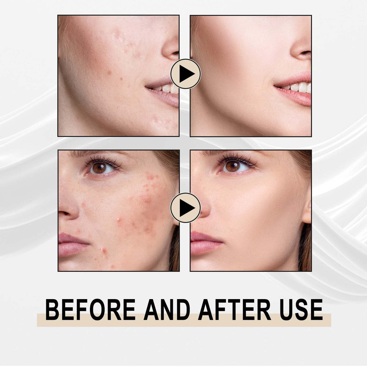 Lactose Solution, Exfoliate Remove Blackheads Shrink Pores Clean And Moisturize SkinEssence