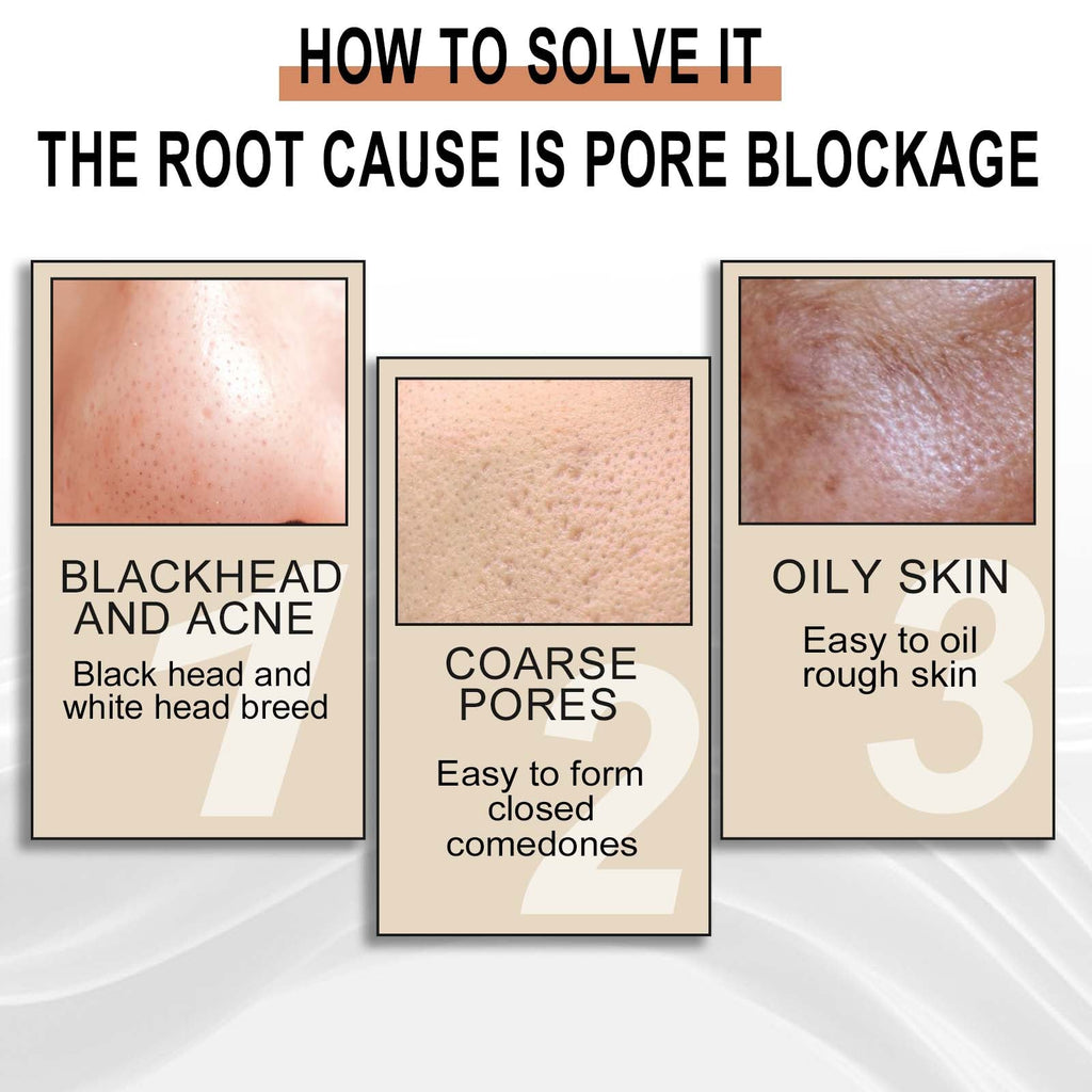 Lactose Solution, Exfoliate Remove Blackheads Shrink Pores Clean And Moisturize SkinEssence