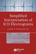 Simplified Interpretation of ICD Electrograms by Hesselson,