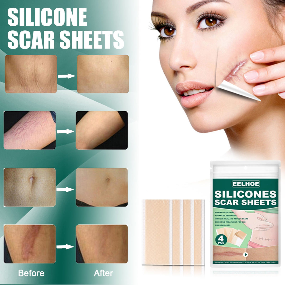 Silicone Gel Repair Patch, Fade Marks Transparent Care Skin Repair Patch