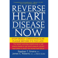 Reverse Heart Disease Now: Stop Deadly Cardiovascular Plaque Before It's Too Late - Paperback